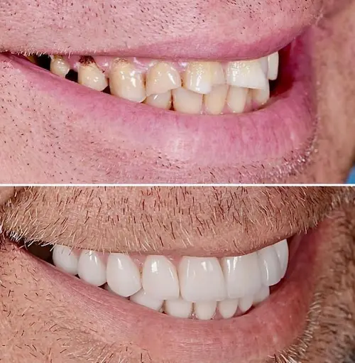 dentist sydney