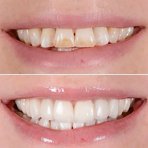 cosmetic dentistry sydney